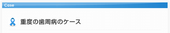 重度の歯周病のケース