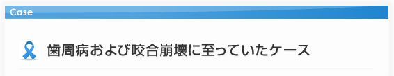 歯周病および咬合崩壊に至っていたケース