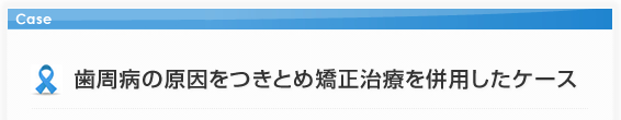 歯周病の原因をつきとめ矯正治療を併用したケース