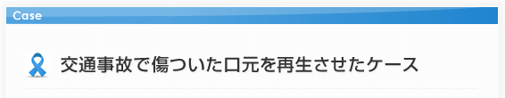 交通事故で傷ついた口元を、骨や歯肉を再生させたケース