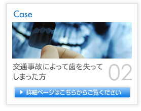 Case02