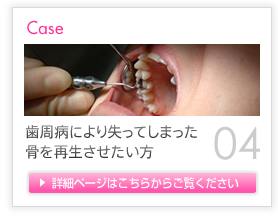 Case04