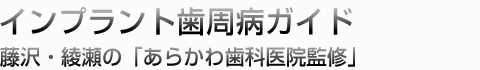 インプラント歯周病ガイド｜藤沢・綾瀬の「あらかわ歯科医院監修」