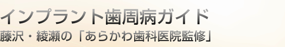 インプラント歯周病ガイド｜藤沢・綾瀬の「あらかわ歯科医院監修」