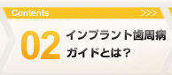 02.インプラント歯周病ガイドとは？