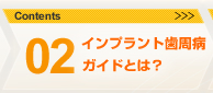 02.インプラント歯周病ガイドとは？