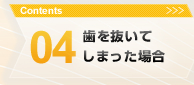 04.歯を抜いてしまった場合