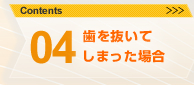 04.歯を抜いてしまった場合